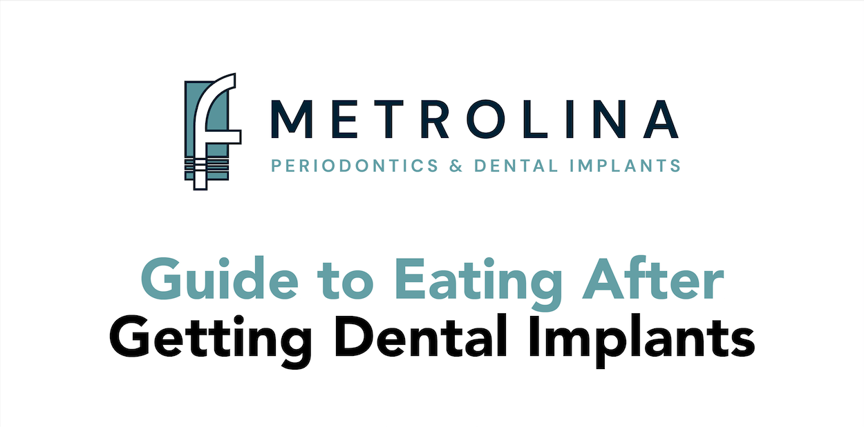 Guide to Eating After Getting Dental Implants