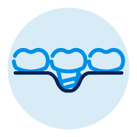 Icon Showing Peri-implantitis and Exposed Implant