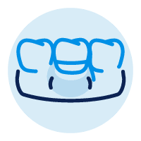 Icon Showing Peri-implantitis and Red Gums